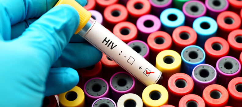 Reported Cases of HIV/AIDS Increasing in State and Locally